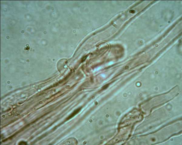 Phlebia tremellosa?